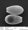 The photo of a testate amoeba's shell (<i>Euglypha</i>) was taken using a scanning electron microscope. If the amoeba was alive, it would protrude from the open end. The shell is approximately 0.04 mm long. Testate amoebae are large Cercozoa. Small amoeba-like Cercozoa (<a href="https://www.youtube.com/watch?v=gRsEES1e3HQ" target="_blank">https://www.youtube.com/watch?v=gRsEES1e3HQ</a>) can be down to 0.003 mm long. testate amoebae appear to be sensitive to the type of drier climate that we expect in the future.