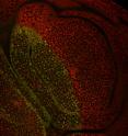 Co-receptors (red) are located on the surfaces of the cells. Pentagone causes the co-receptors to become internalized and degraded within the cell (yellow/green).