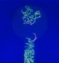 Small colonies of genetically identical mycobacteria growing in a microfluidic chamber. Individual mycobacteria will respond differently when exposed to a common antibiotic, depending on growth and timing factors.