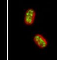<i>Synechococcus</i> 7002 cells under typical light conditions (left) and under bright light for a long period of time (right). The cells on the right are much larger to accommodate additional cell-synthesis machinery required under high light-energy conditions.