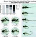 These are examples of severe deformities found in larval haddock exposed to crude oil.