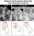 Exposure to crude oil leads to various deformities in the hearts of embryonic haddock and other fish species.
