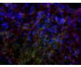 Stained image of human pluripotent stem cells cultured in adenosine to induce differentiation into functional osteoblasts.
