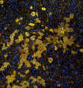 These are regenerative liver cells eight weeks after transplantation.