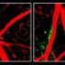 Destructive enzymes (shown in green) become more active and weaken the blood-brain barrier in mice that are genetically engineered to produce only human ApoE4 (right), rather than mouse ApoE (left).