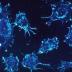 A research team led by two scientists at Penn State University has developed a promising cancer-fighting strategy for "reactivating" genes that cause cancer tumors to shrink and die. This image is a microscopic view of cancer cells. The researchers hope that their discovery will aid in the development of an innovative anti-cancer drug that effectively targets unhealthy, cancerous tissue without damaging healthy, non-cancerous tissue and vital organs.