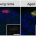These fluorescent microscope images of testes from young (left) and old (right) fruit flies show the effect of aging on the stem cell niche (top center). The hub cells (red) that function as part of the stem cells' supporting niche express more of a microRNA known as let-7 (green) in aged flies, which changes the signaling properties of hub cells, leading to fewer stem cells surrounding the hub that are available for tissue maintenance.