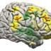 This image shows the changes that took place in the brain for all patients participating in the study using a brain-computer interface. Changes in activity were distributed widely throughout the brain.