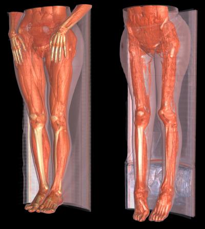  Scientific Discoveries on This Image Represents 3 D Reconstructions From Ct Scans Of A Healthy