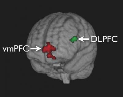 dlpfc brain