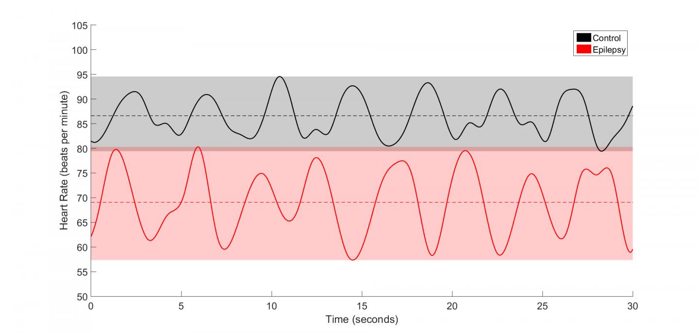 changes-in-heart-activity-may-signal-epilepsy-e-science-news