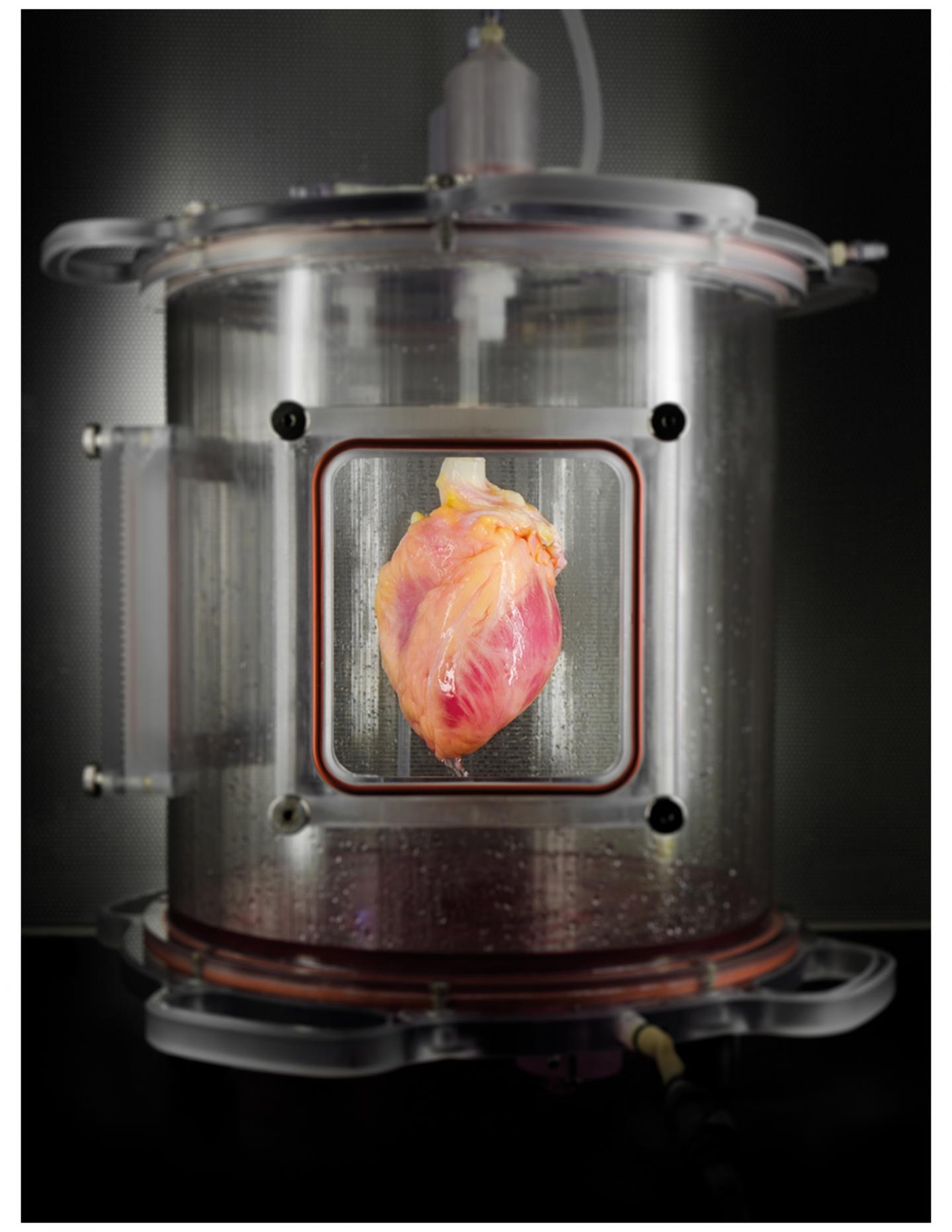 Functional heart muscle regenerated in decellularized human hearts (e