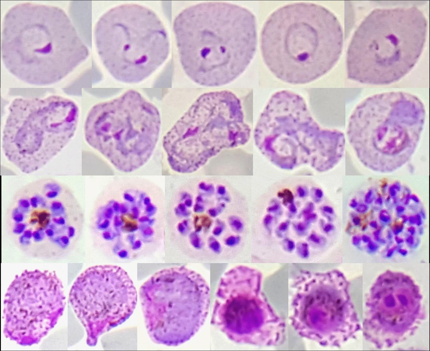 gene-sequences-reveal-global-variations-in-malaria-parasites-e