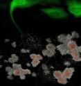 Shown in green are genetically-corrected fibroblasts from Fanconi anemia patients are reprogrammed to generate induced pluripotent stem cells, which, in turn, can be differentiated into disease-free hematopoietic progenitors, capable of producing blood cells in vitro. Shown in green are genetically-corrected fibroblasts from Fanconi anemia patients are reprogrammed to generate induced pluripotent stem cells, which, in turn, can be differentiated into disease-free hematopoietic progenitors, capable of producing blood cells in vitro.