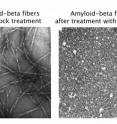 Alzheimer's fibers without DAPH (left). Note uniform fibers. Alzheimer's proteins with DAPH (right). Note fibers have broken up.