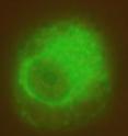 A fluorescent image of the cell taken four hours into the same experiment. At this time the quantum dot-siRNA complex is distributed throughout the cellular fluid. The dark region in the middle of the cell is the nucleus.