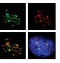 Top left: Molecular fence posts (shown in green) separate active from inactive chromosomal neighborhoods areas. Top right: RNA polymerase 2 (shown in red) reads genes in active neighborhoods. Bottom left: Intact fences co-localize with areas of gene activity. Areas of overlap show up in yellow. Bottom right: DNA is shown in blue.