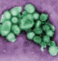 This colorized negative stained transmission electron micrograph (TEM) depicts some of the ultrastructural morphology of the A/CA/4/09 swine flu virus.