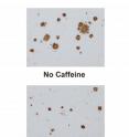 Caffeine treatment removed the beta amyloid plaques from the brains of the Alzheimer's mice.