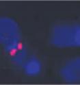 Damaged chromosomes in mouse B cells, left, can be incorrectly repaired and lead to cancer. At right are intact chromosomes.