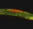 Research on this microscopic worm (<i>Caenorhabditis elegans</i>) may offer a drug target for cancer treatment.