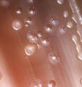 <i>Streptococcus pneumoniae</i>, growing in this laboratory culture dish, cause community-acquired pneumonia.