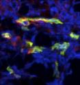 Vascular endothelial cells (green) express {delta}-catenin (red).