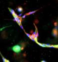 This is an image of capillaries in the lab showing expression of genes normally present only in lymphatic cells. This is an image of capillaries in the lab showing expression of genes normally present only in lymphatic cells.