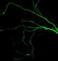 This is a fluorescently labeled neuron in which the apoptosis pathway is inhibited.