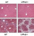 Treated with a control substance, livers from normal and LXR-deficient mice appear identical and undamaged (top left and right). The bottom images show the greater degree of fibrosis (blue bands) in the livers of mice lacking LXRs (right) compared to normal mice (left) after liver injury. Treated with a control substance, livers from normal and LXR-deficient mice appear identical and undamaged (top left and right). The bottom images show the greater degree of fibrosis (blue bands) in the livers of mice lacking LXRs (right) compared to normal mice (left) after liver injury.