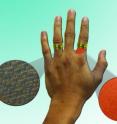 Researchers from Brigham and Women's Hospital (BWH) believe that nanoparticles added to a cream or coated on a nickel-containing object could prevent the itchy redness associated with an allergy to the nickel found in everyday objects like rings. In this cartoon, a nanoparticle cream applied to the ring finger prevents inflammation from the nickel in a ring (brownish particles represent a thin barrier layer of nanoparticles). The forefinger, without the cream, is inflamed after exposure to the ring and its nickel.