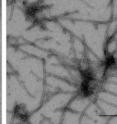 Unsumoylated alpha-synuclein aggregates into fibrils (right), whereas sumoylated alpha-synuclein doesn't (left). New research in the <i>Journal of Cell Biology </i>suggests that sumoylation might prevent the protein aggregations that typify Parkinson’s disease.
