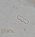 A phytolith, this one from a grass, range in size from 5 to 250 microns and vary in appearance depending on the kind of plant they come from.