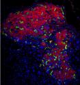 This is an immunostained image of engrafted islet in hydrogel in diabetic mouse. Red areas are insulin, green areas are blood vessels and blue areas are the DNA nuclei in cells. This is an immunostained image of engrafted islet in hydrogel in diabetic mouse. Red areas are insulin, green areas are blood vessels and blue areas are the DNA nuclei in cells.