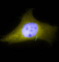 A cilium stands out in blue fluorescence against the yellow fluorescence of the rest of the cell.