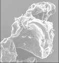 This is a scanning electron micrograph of <i>Sulfolobus solfataricus</i> cells infected with STIV, showing pyramid-like structures on the surface of the cell. This is a scanning electron micrograph of <i>Sulfolobus solfataricus</i> cells infected with STIV, showing pyramid-like structures on the surface of the cell.