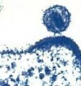 HIV is shown budding from an infected cell. Similar versions of HIV infect other nonhuman species, such as feline immunodeficiency virus in cats and simian immunodeficiency virus in monkeys and other nonhuman primates. HIV is shown budding from an infected cell. Similar versions of HIV infect other nonhuman species, such as feline immunodeficiency virus in cats and simian immunodeficiency virus in monkeys and other nonhuman primates.