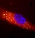 <p>The glowing yellow specks in the image show uptake of the nanosponge vaccine by a mouse dendritic cell -- an immune-system cell. The detained alpha-haemolysin toxins were labeled with a fluorescent dye which glows yellow. The nanosponge vaccine with detained toxins and can be seen glowing yellow after uptake by the dendritic cell. The cell is membrane stained red and the nuclei stained blue. 
<p>Nanosponges that soak up a dangerous pore-forming toxin produced by MRSA (methicillin-resistant <i>Staphylococcus aureus</i>) could serve as a safe and effective vaccine against this toxin. This "nanosponge vaccine" enabled the immune systems of mice to block the adverse effects of the alpha-haemolysin toxin from MRSA -- both within the bloodstream and on the skin. Nanoengineers from UC San Diego described the safety and efficacy of this nanosponge vaccine in the Dec. 1 issue of <i>Nature Nanotechnology</i>.