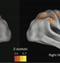 When these brain regions (mostly associated with control) aren't active enough, we make risky choices. Z-statistic corresponds to predictive ability, yellow being the most predictive regions.