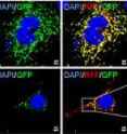 Mitochondria in hepatitis C-infected cells (bottom row) are self-destructing. The self-annihilation process explains the persistance and virulence of the virus in human liver cells.