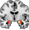 This image of the brain shows the amygdala, a region of that helps shape behavioral and biological responses to threat the stress. The amygdala is a region in the temporal lobe of the brain that helps shape behavioral and biological responses to threat and stress.