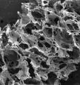 This is an image of silk-based scaffold taken with a scanning electron microscope reveals its porous, sponge-like composition.