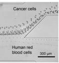 This image shows the end portion of separation stream separating cancer cells from red blood cells in the tilted-angle standing surface acoustic wave-based cell-separation device.