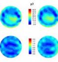 These are internal, spatially mapped microwave tomography system generated electrical property distribution images of a cancer patient's left breast, taken somewhat into her therapy. Shown are permittivity and conductivity image sets (top and bottom image series, respectively) reconstructed at 1100 MHz. Each plane (i.e., p1 - p7) identifies a different location within system where the image was taken, and is relative to the chest wall. You can clearly see the breast outline and the features inside the breast relate to fibroglandular tissue inside the adipose tissue. This breast has undergone treatment and so most of the tumor has disappeared.