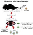 This visual abstract the findings of Miner et al., who describe how ZIKV infection in the eye results in inflammation and injury. ZIKV infected the iris, cornea, retina, and optic nerve and caused conjunctivitis, panuveitis, and neuroretinitis in mice. This manuscript establishes a model for evaluating treatments for ZIKV infections in the eye.
